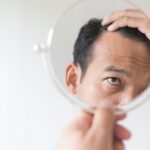 best hair-loss treatment - b16 clinic